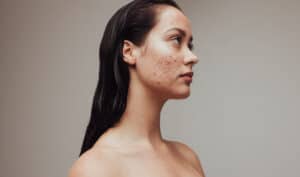 , Patient information