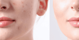 , Everything Skin Clinic
