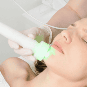 , Acne Treatment in London