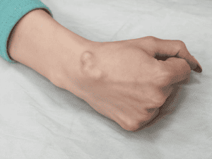 , Treatments