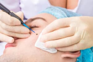 , Treatments