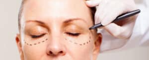 , Treatments