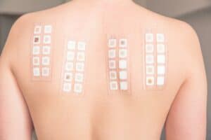 , Treatments