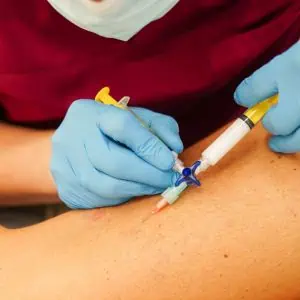Sclerotherapy London