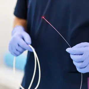 Varicose veins removal London