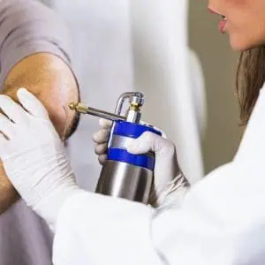 cryotherapy near me