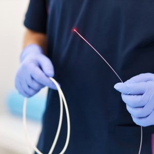 endovenous laser treatment