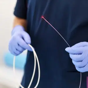 endovenous laser treatment