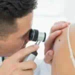 mole check london