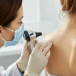 mole check near me