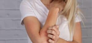 Skin allergies London