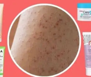 dermatology advice Yours