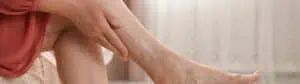 Varicose Vein Treatment London